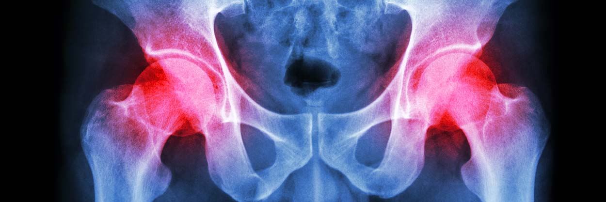 human's pelvis and hip joints with pain